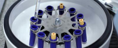 How to Balance Centrifuge Samples